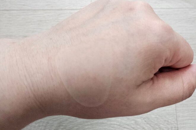 marshique-wrinkle-repair-patch-applied-on-skin